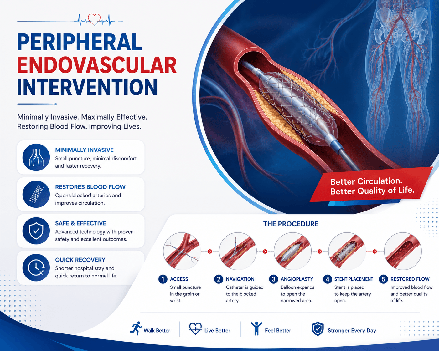 Peripheral Endovascular Interventions
